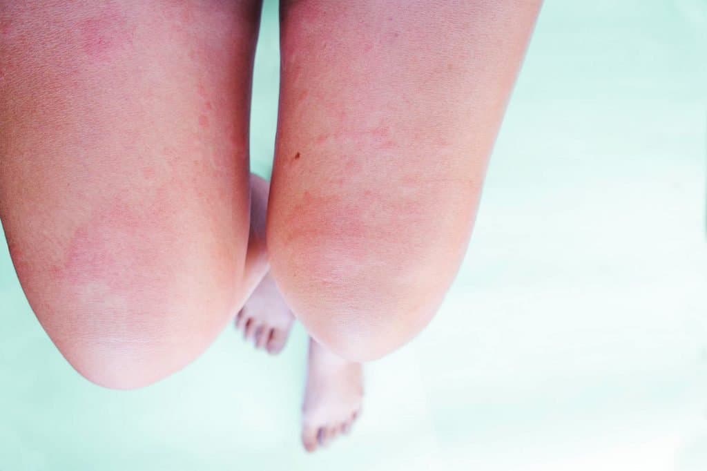 Sir Agda Nasil Yapilir 3